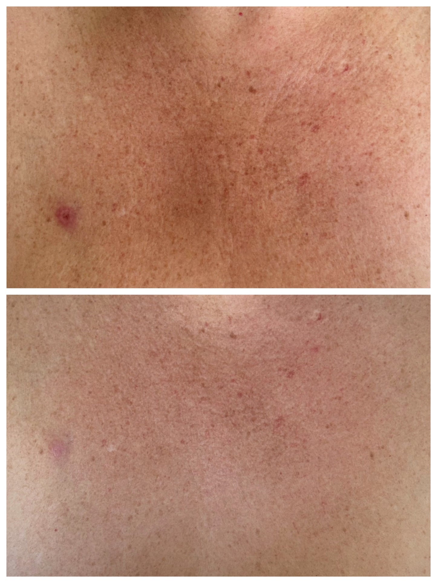 PRESALE | Venom 32 Mini Peel 50ml