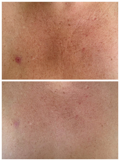 PRESALE | Venom 32 Mini Peel 50ml